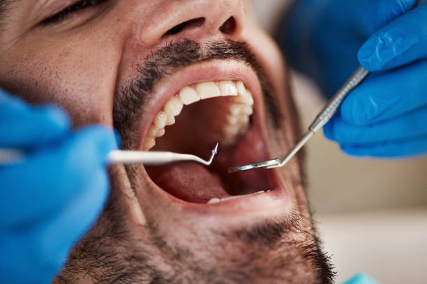 Oral Surgery in Pagedale, MO